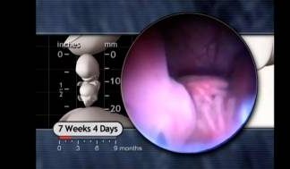 Este video muestra que un embrión de 7 semanas es ser humano